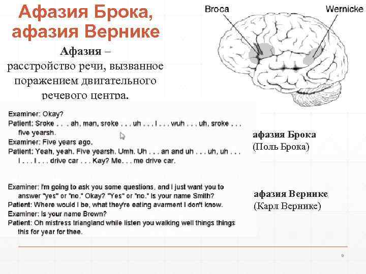 Афазия Брока, афазия Вернике Афазия – расстройство речи, вызванное поражением двигательного речевого центра. афазия