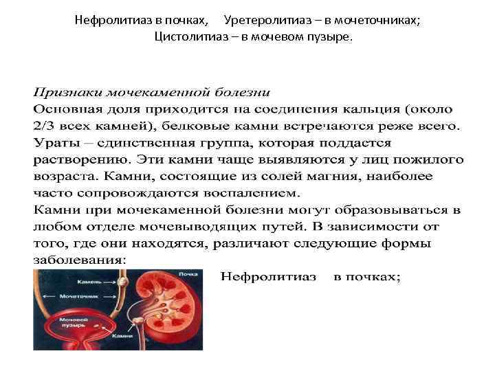 Нефролитиаз в почках, Уретеролитиаз – в мочеточниках; Цистолитиаз – в мочевом пузыре. 