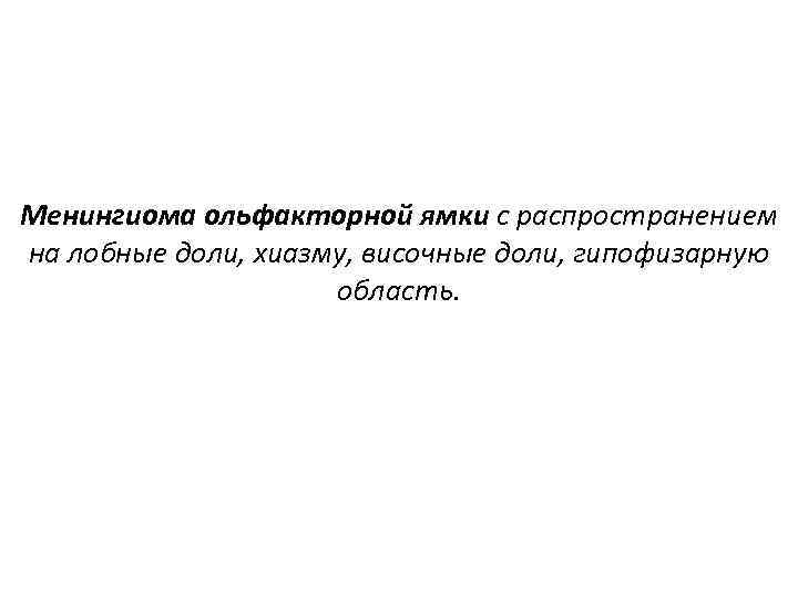 Менингиома ольфакторной ямки с распространением на лобные доли, хиазму, височные доли, гипофизарную область. 