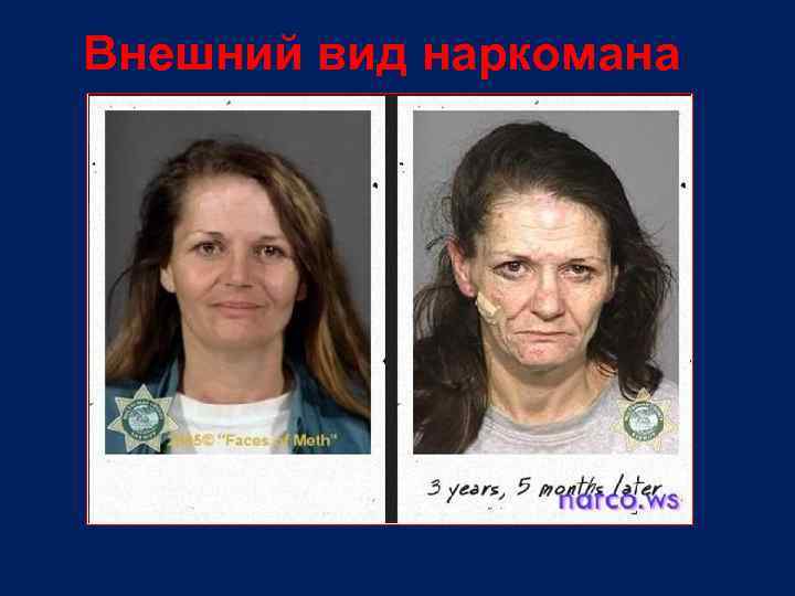 Внешний вид наркомана 