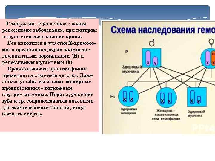  Гемофилия сцепленное с полом рецессивное заболевание, при котором нарушается свертывание крови. Ген находится