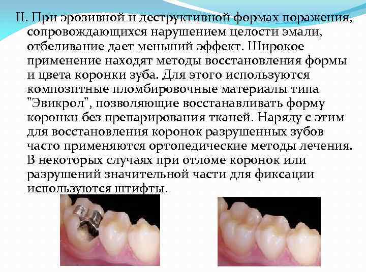 II. При эрозивной и деструктивной формах поражения, сопровождающихся нарушением целости эмали, отбеливание дает меньший