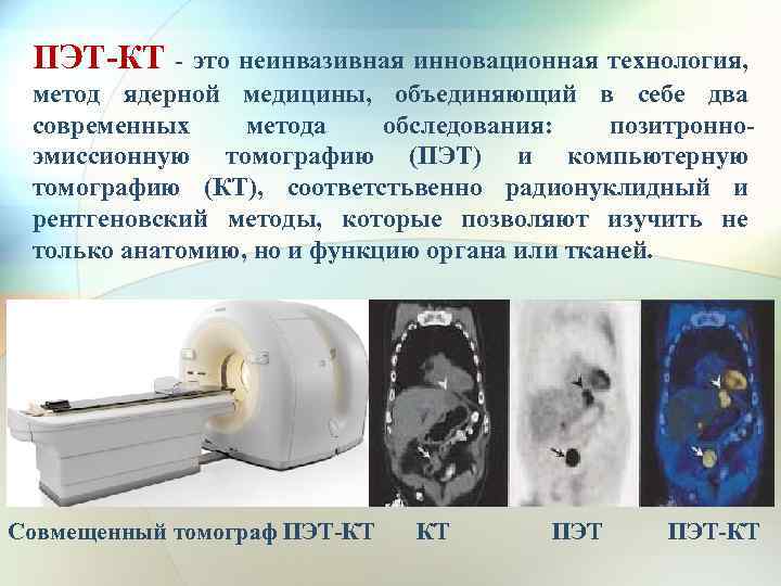 ПЭТ-КТ - это неинвазивная инновационная технология, метод ядерной медицины, объединяющий в себе два современных