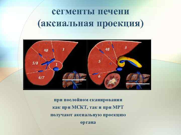 сегменты печени (аксиальная проекция) при послойном сканировании как при МСКТ, так и при МРТ