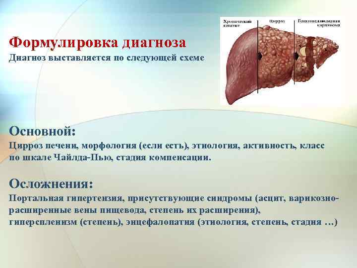 Формулировка диагноза Диагноз выставляется по следующей схеме Основной: Цирроз печени, морфология (если есть), этиология,