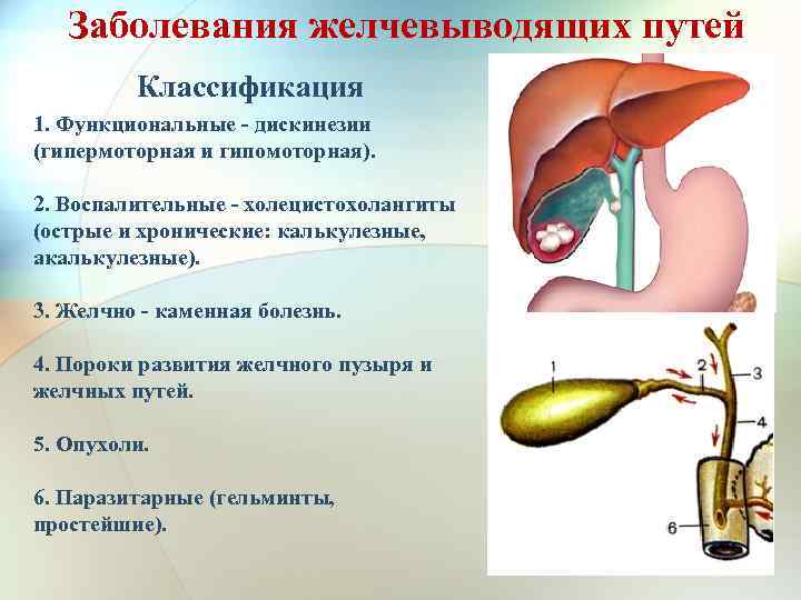 Заболевания желчевыводящих путей Классификация 1. Функциональные - дискинезии (гипермоторная и гипомоторная). 2. Воспалительные -