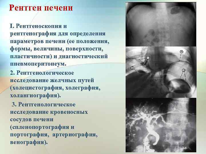 При рентгеноскопии изображение получается