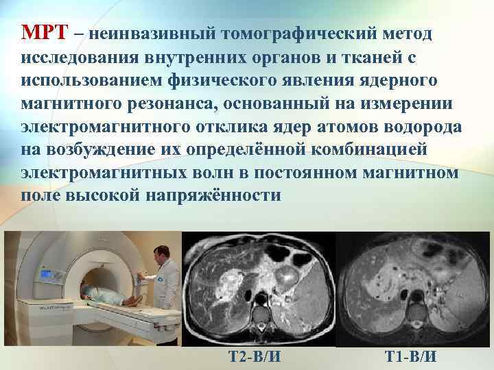 МРТ – неинвазивный томографический метод исследования внутренних органов и тканей с использованием физического явления