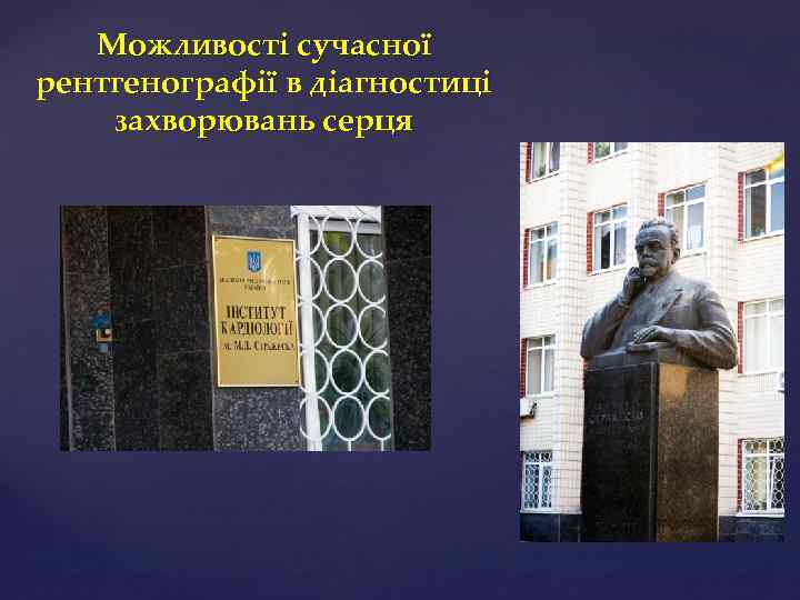 Можливості сучасної рентгенографії в діагностиці захворювань серця 