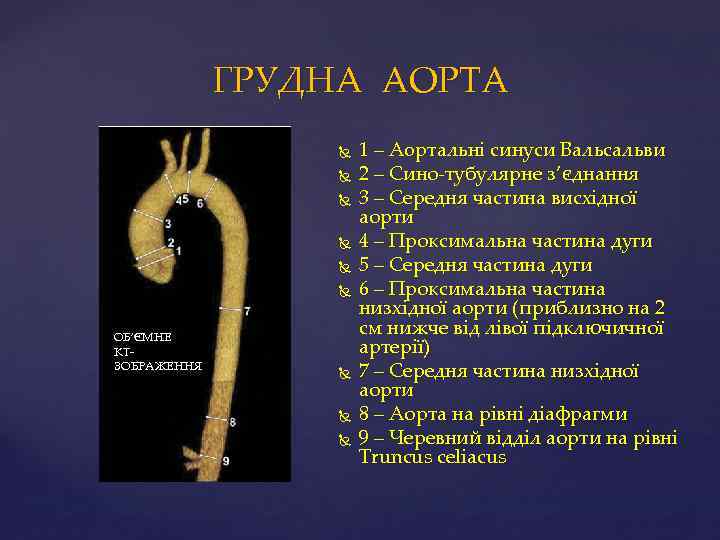 ГРУДНА АОРТА ОБ’ЄМНЕ КТЗОБРАЖЕННЯ 1 – Аoртальні синуси Вальсальви 2 – Сино-тубулярне з’єднання 3