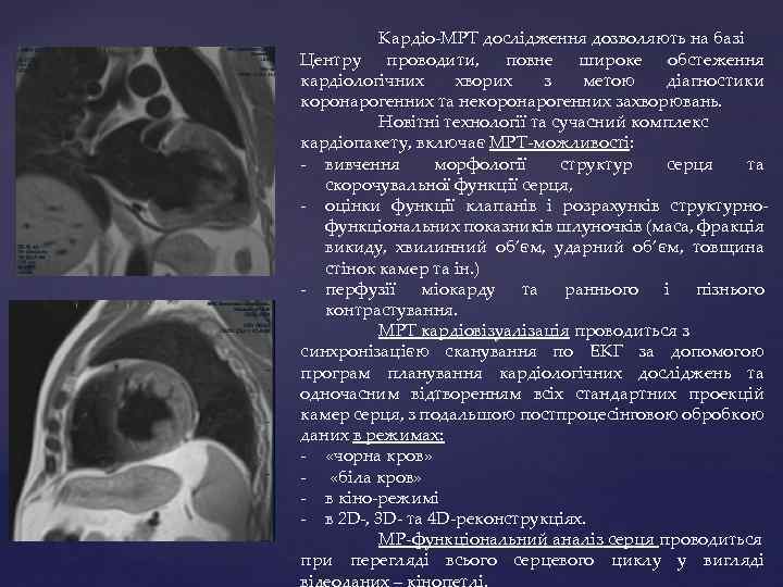 Кардіо-МРТ дослідження дозволяють на базі Центру проводити, повне широке обстеження кардіологічних хворих з метою