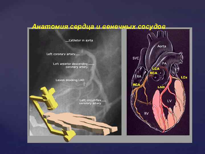 Анатомия сердца и венечных сосудов 
