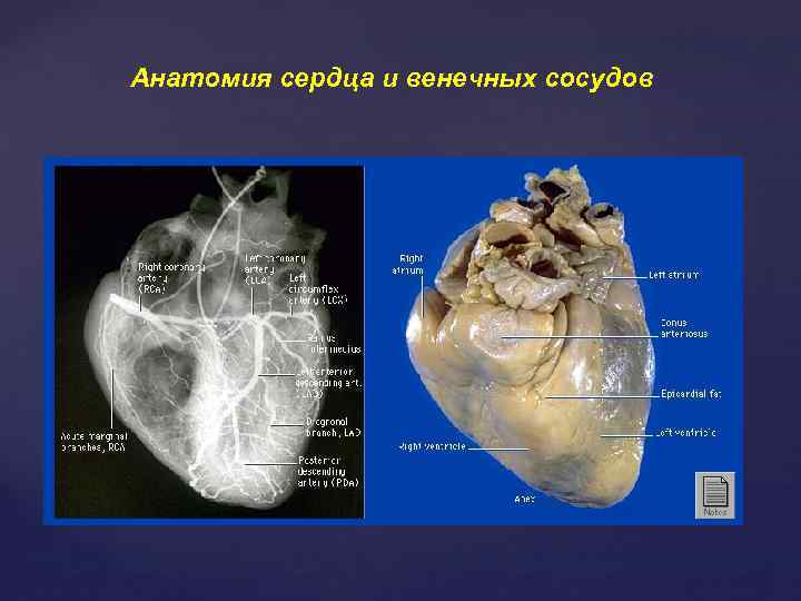 Анатомия сердца и венечных сосудов 