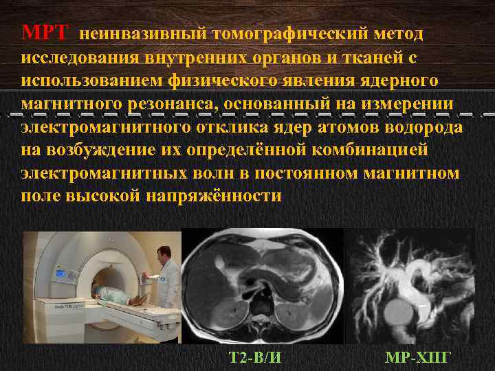 МРТ неинвазивный томографический метод исследования внутренних органов и тканей с использованием физического явления ядерного