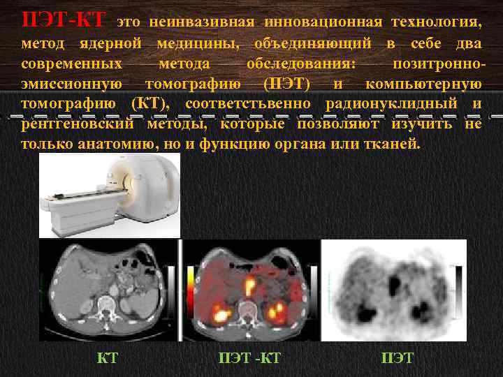 Пэт кт что это за исследование. Позитронно-эмиссионная томография лучевая диагностика. ПЭТ метод обследования. ПЭТ лучевая диагностика. ПЭТ кт лучевая нагрузка.