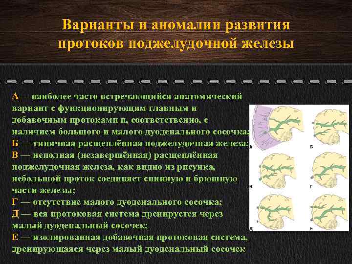 Аномалии развития. Варианты развития поджелудочной железы. Аномалии развития поджелудочной железы. Аномалии протоков поджелудочной железы. Варианты развития протоков поджелудочной железы.