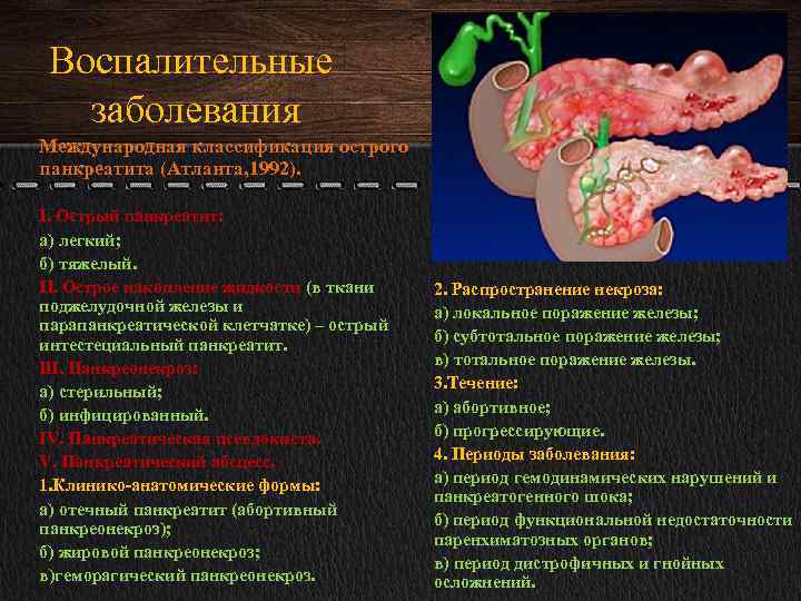 Воспалительные заболевания Международная классификация острого панкреатита (Атланта, 1992). I. Острый панкреатит: а) легкий; б)