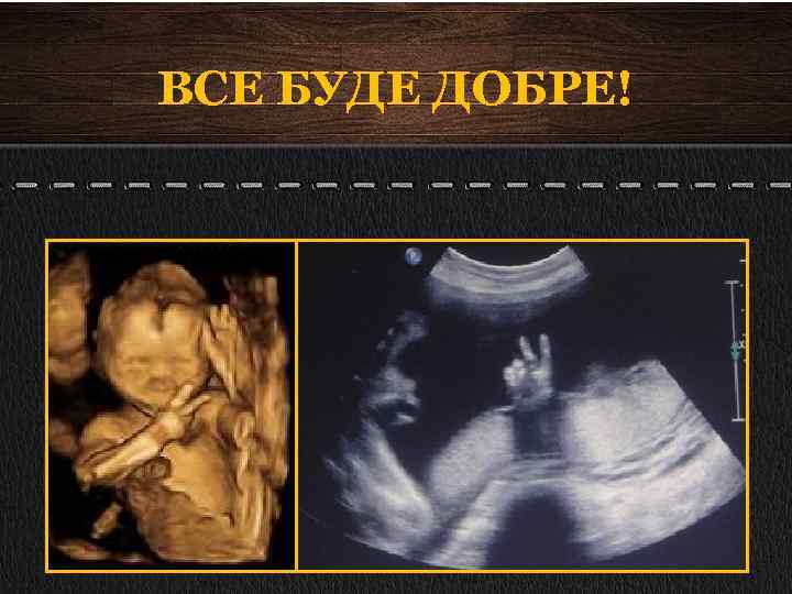 ВСЕ БУДЕ ДОБРЕ! 