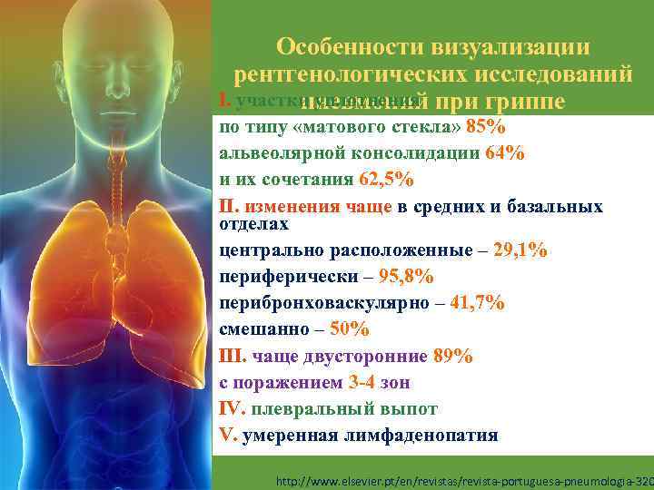 Особенности визуализации рентгенологических исследований I. участки уплотнения пневмоний при гриппе по типу «матового стекла»