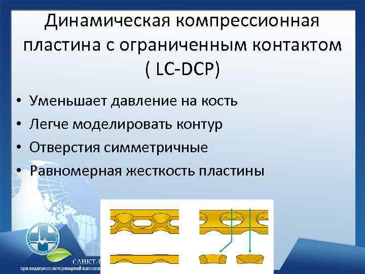 Динамическая компрессионная пластина c ограниченным контактом ( LC-DCP) • • Уменьшает давление на кость