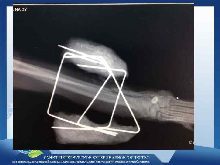 Лечение переломов презентация