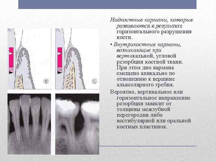 Карта исследования пародонта