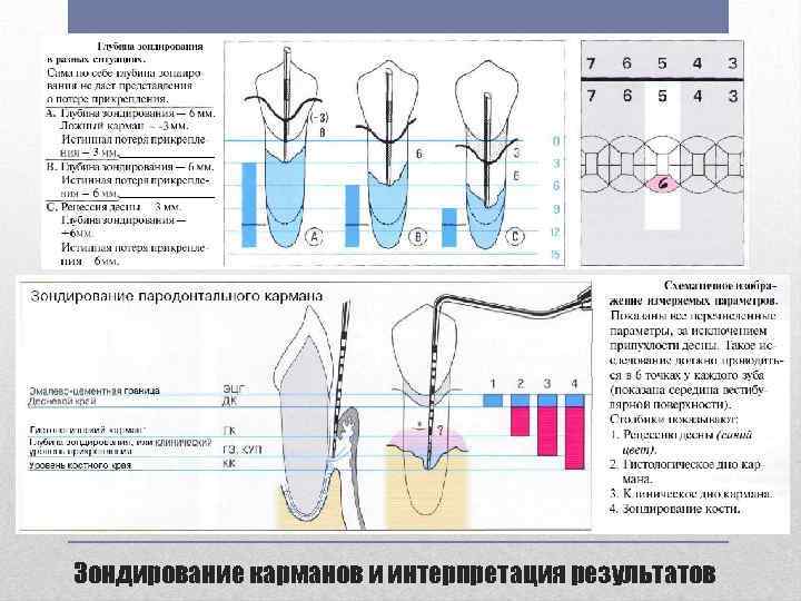 Карта исследования пародонта