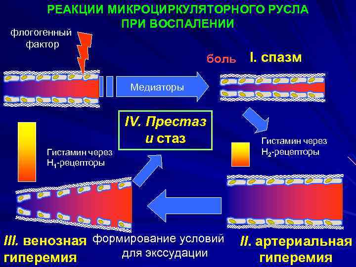 РЕАКЦИИ МИКРОЦИРКУЛЯТОРНОГО РУСЛА ПРИ ВОСПАЛЕНИИ флогогенный фактор боль I. спазм Медиаторы IV. Престаз и