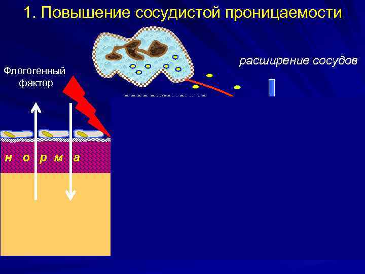 1. Повышение сосудистой проницаемости расширение сосудов Флогогенный фактор вазоактивные медиаторы Н 20 + б