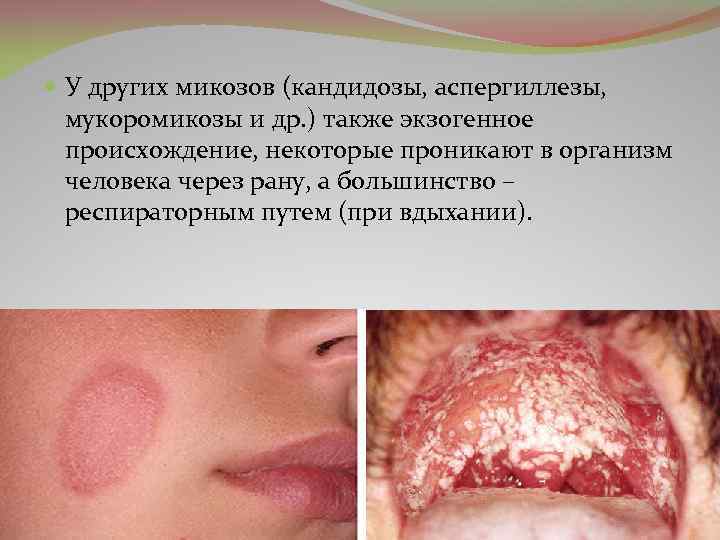 У других микозов (кандидозы, аспергиллезы, мукоромикозы и др. ) также экзогенное происхождение, некоторые