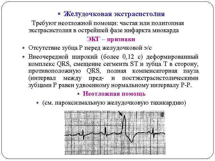  Желудочковая экстрасистолия Требуют неотложной помощи: частая или политопная экстрасистолия в острейшей фазе инфаркта