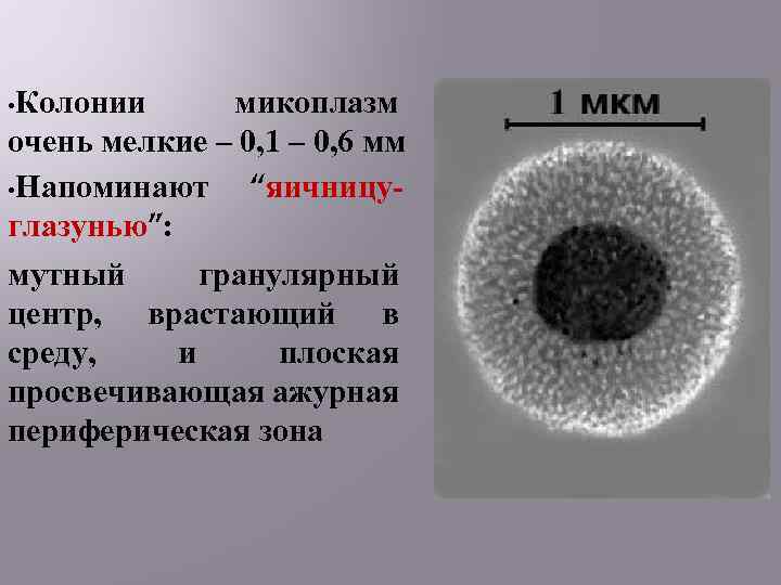  • Колонии микоплазм очень мелкие – 0, 1 – 0, 6 мм •