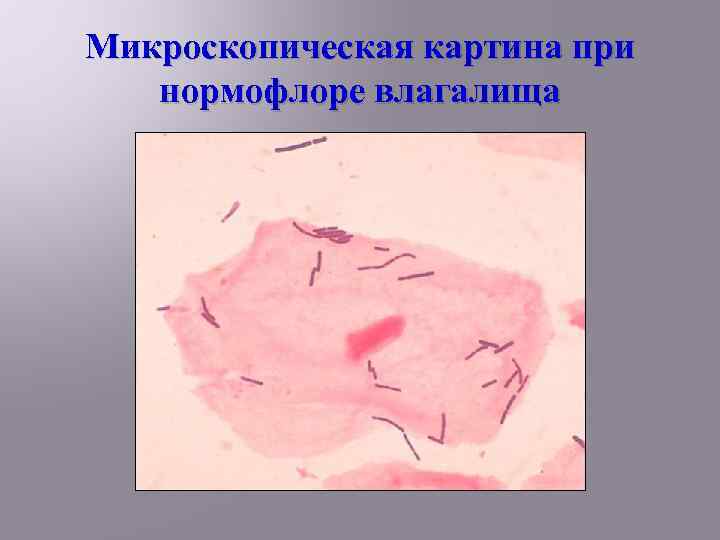 Микроскопическая картина при нормофлоре влагалища 