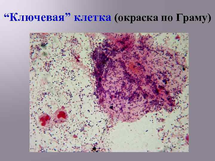 “Ключевая” клетка (окраска по Граму) 