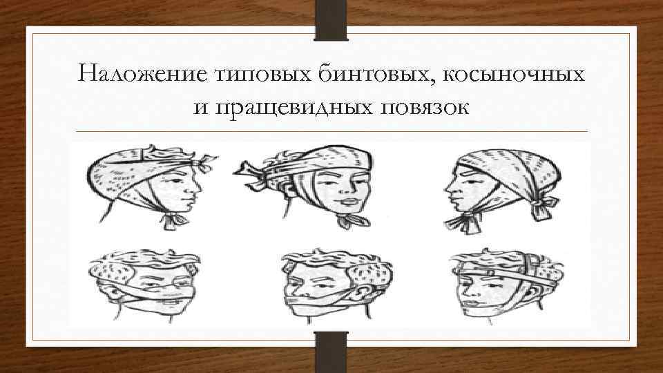 Наложение типовых бинтовых, косыночных и пращевидных повязок 