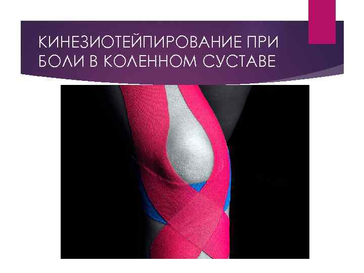 КИНЕЗИОТЕЙПИРОВАНИЕ ПРИ БОЛИ В КОЛЕННОМ СУСТАВЕ 