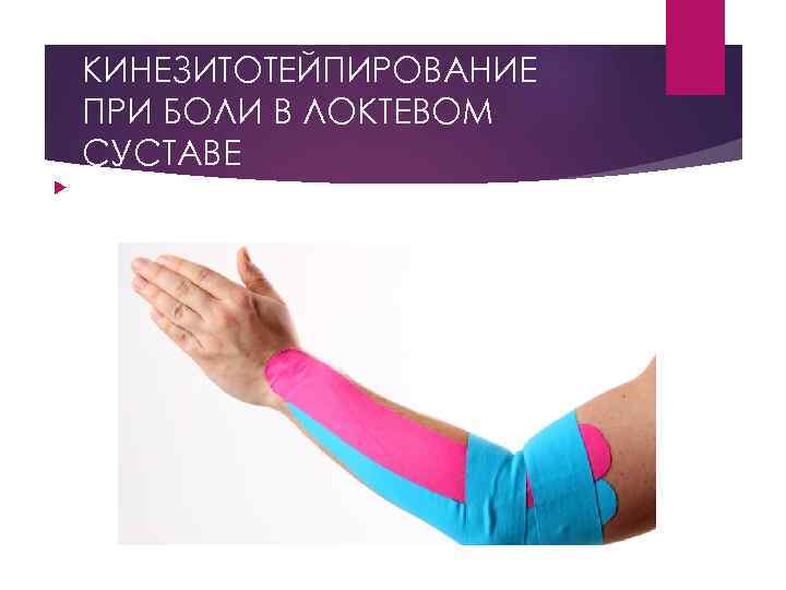 КИНЕЗИТОТЕЙПИРОВАНИЕ ПРИ БОЛИ В ЛОКТЕВОМ СУСТАВЕ 