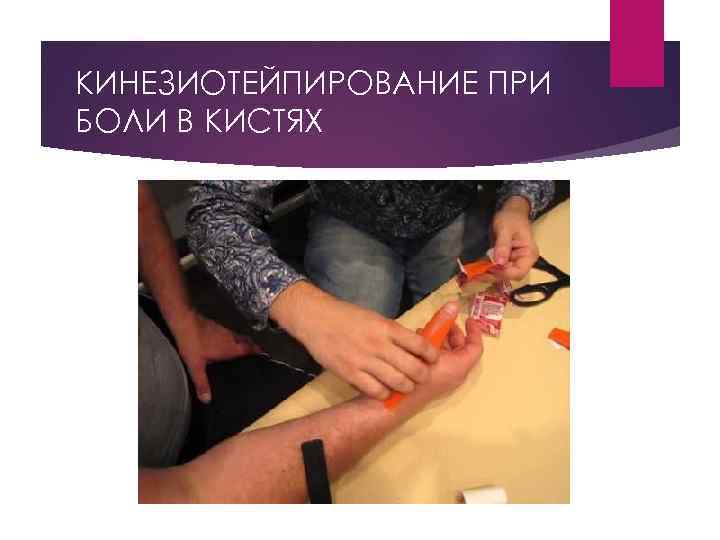 КИНЕЗИОТЕЙПИРОВАНИЕ ПРИ БОЛИ В КИСТЯХ 