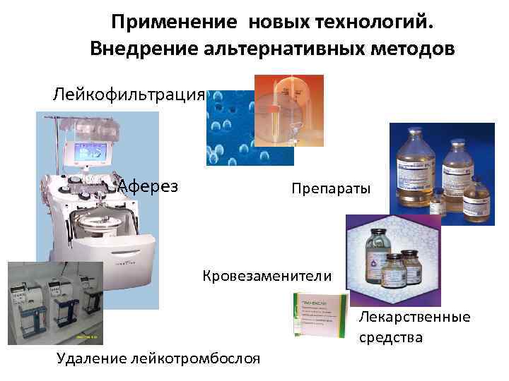 Применение новых технологий. Внедрение альтернативных методов Лейкофильтрация Аферез Препараты Кровезаменители Лекарственные средства Удаление лейкотромбослоя