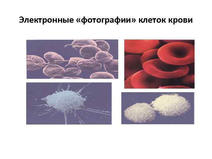 Электронные «фотографии» клеток крови 