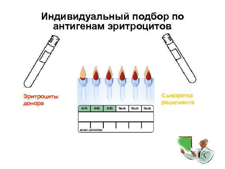 Индивидуальный подбор по антигенам эритроцитов Эритроциты донора Сыворотка реципиента 