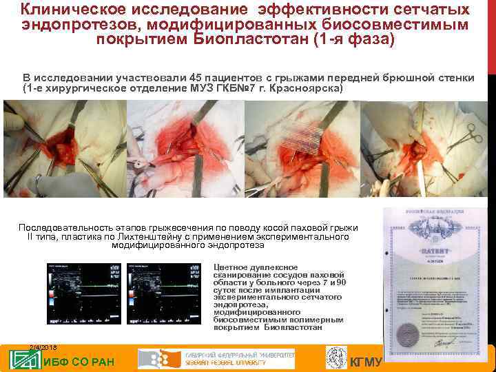 Клиническое исследование эффективности сетчатых эндопротезов, модифицированных биосовместимым покрытием Биопластотан (1 -я фаза) В исследовании