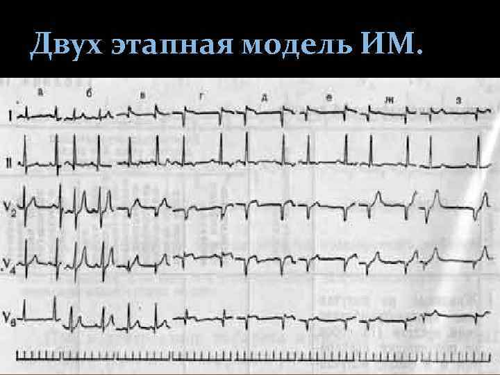 Двух этапная модель ИМ. 