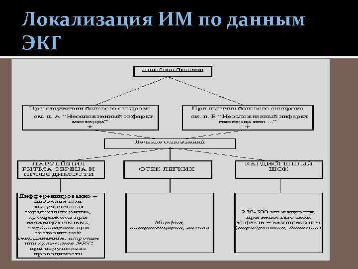 Локализация ИМ по данным ЭКГ 