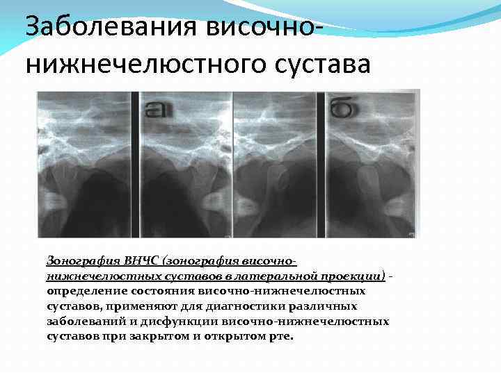 Лучевая диагностика внчс презентация