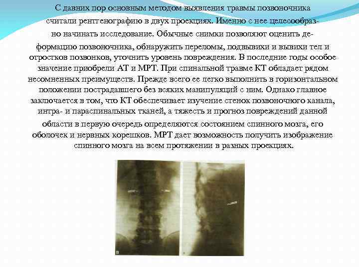 С давних пор основным методом выявления травмы позвоночника считали рентгенографию в двух проекциях. Именно