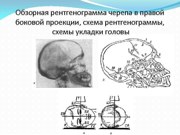 Описание рентгенограммы схема