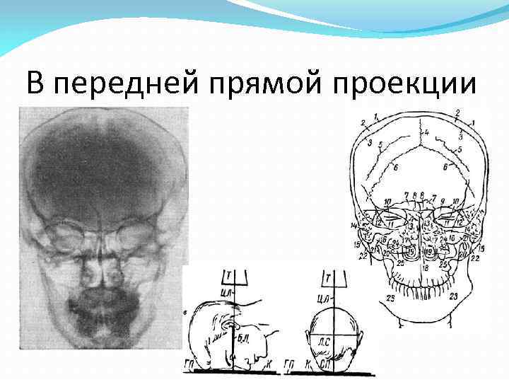 В передней прямой проекции 