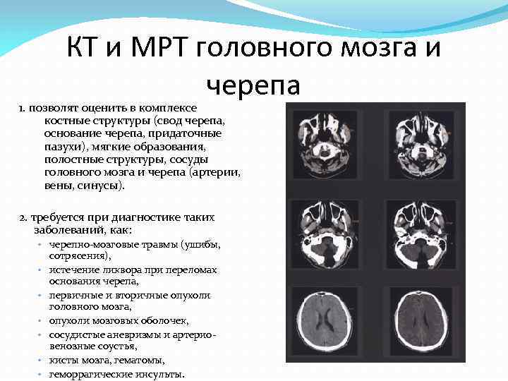 Кт анатомия черепа. Лучевые методы исследования черепа и головного мозга.. Методы лучевой диагностики головного мозга.. Анатомия основания черепа на кт. Кт анатомия головного мозга.