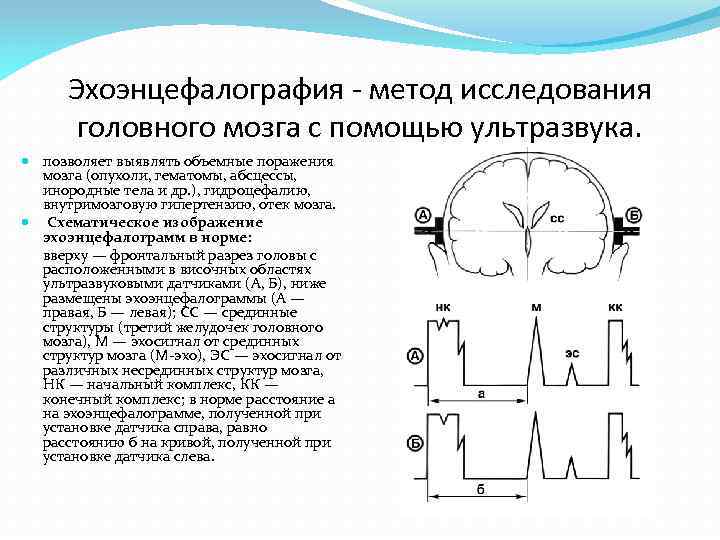 Эхо расстояние